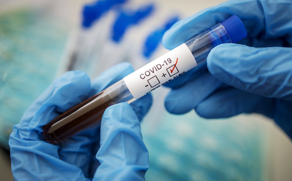 В случаях подозрения на COVID-19 пациентам бесплатно будут проводить забор крови для проведения ИФА-диагностики